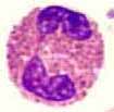 Eosinophil