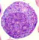 Metamyelocyte