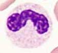 Stabkerniger Neutrophiler